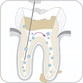 Zahnspülung